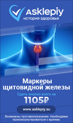 Анализ 3